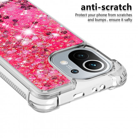 Xiaomi Mi 11 Glitter Design Case