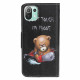 Xiaomi Mi 11 Lite / Lite 5G Dangerous Bear Case