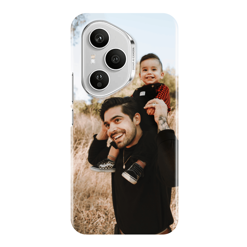 Customised Honor 400 Pro case