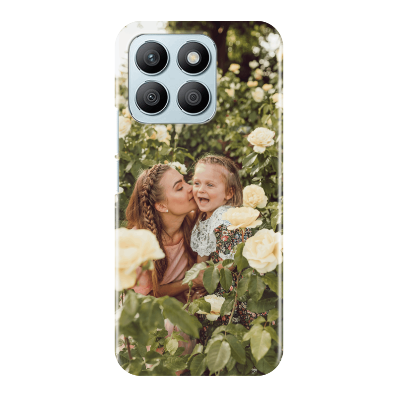 Customised Honor X8b case