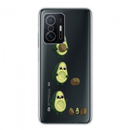 Coque Xiaomi 11T Das Leben eines Avocados