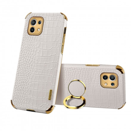 Xiaomi Mi 11 X-CASE Custodia in pelle di coccodrillo