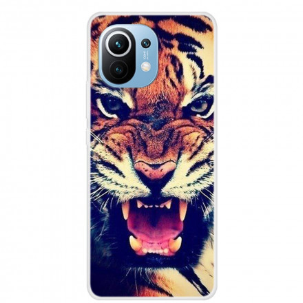 Custodia Xiaomi Mi 11 Tiger Face