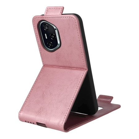 Honor 400 Design case...